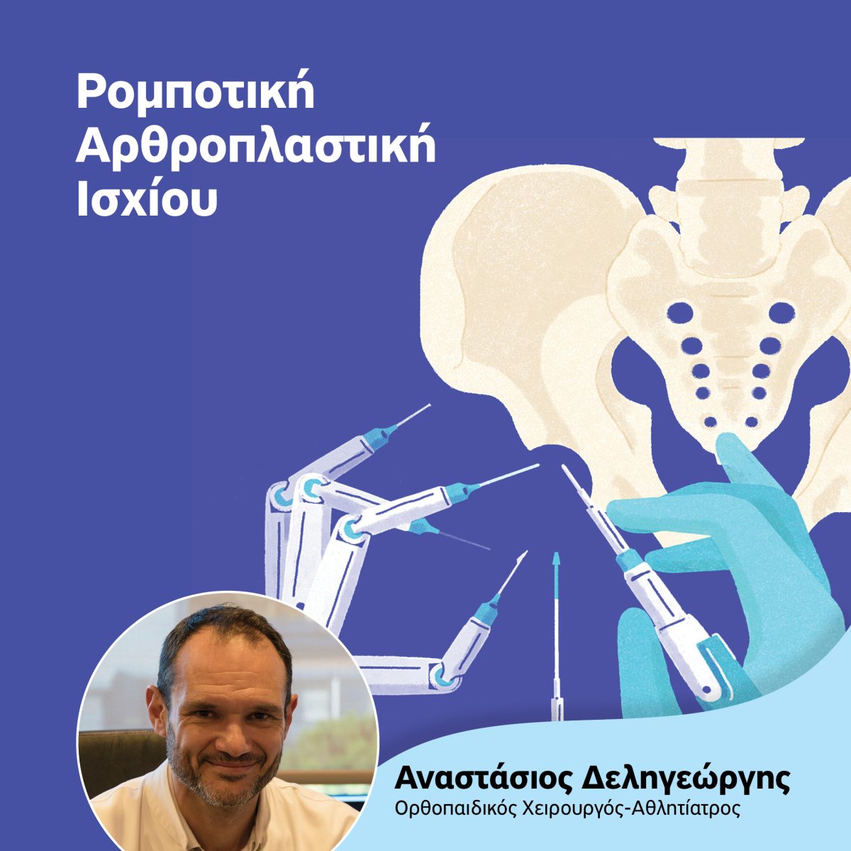 Ρομποτική Αρθοπλαστική Ισχίου: Γιατί πλεονεκτεί