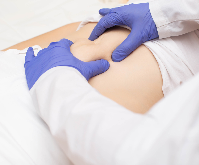 Βουβωνοκήλη: Συμπτώματα, κίνδυνοι και θεραπεία