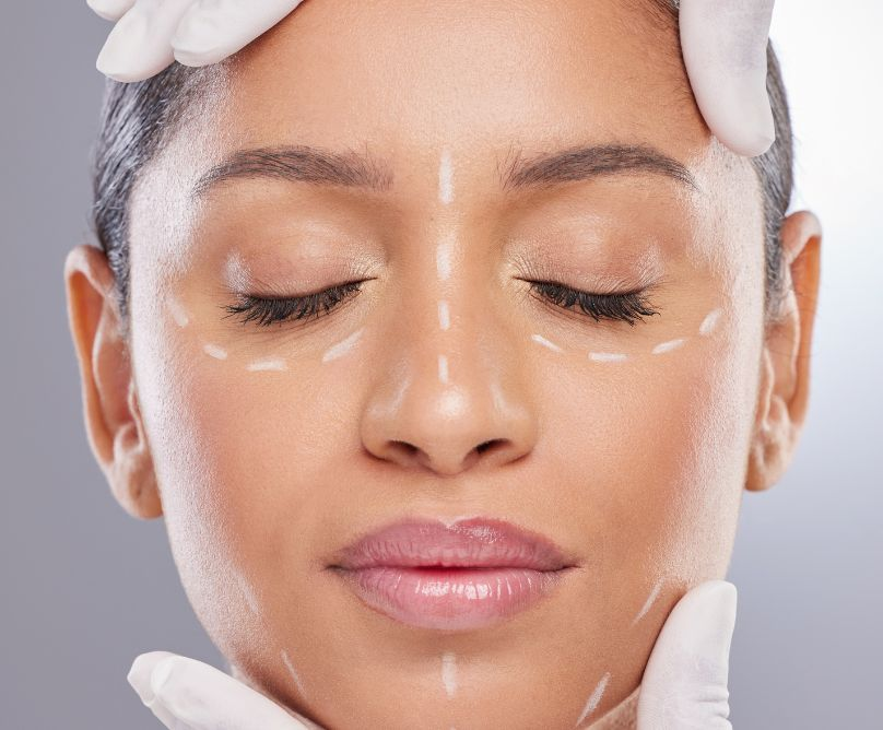 Βοτουλινική τοξίνη: Συμβουλές μετά τη θεραπεία για βέλτιστο αποτέλεσμα