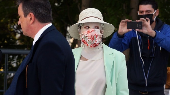 Επίθεση με βιτριόλι: Εξετάζονται ως μάρτυρες οι γιατροί της Ιωάννας