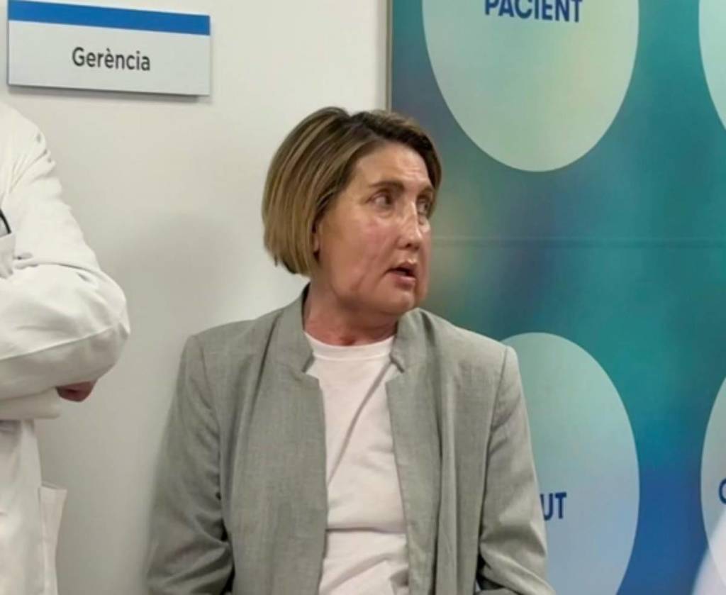 Ιατρική επανάσταση: Η πρώτη μεταμόσχευση προσώπου με δότρια γυναίκα που υποβλήθηκε σε υποβοηθούμενη ευθανασία