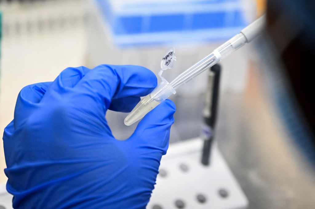 Η Ισπανία ειδοποιεί τον ΠΟΥ για μετάδοση από άνθρωπο σε άνθρωπο μιας παραλλαγής του ιού της γρίπης των χοίρων