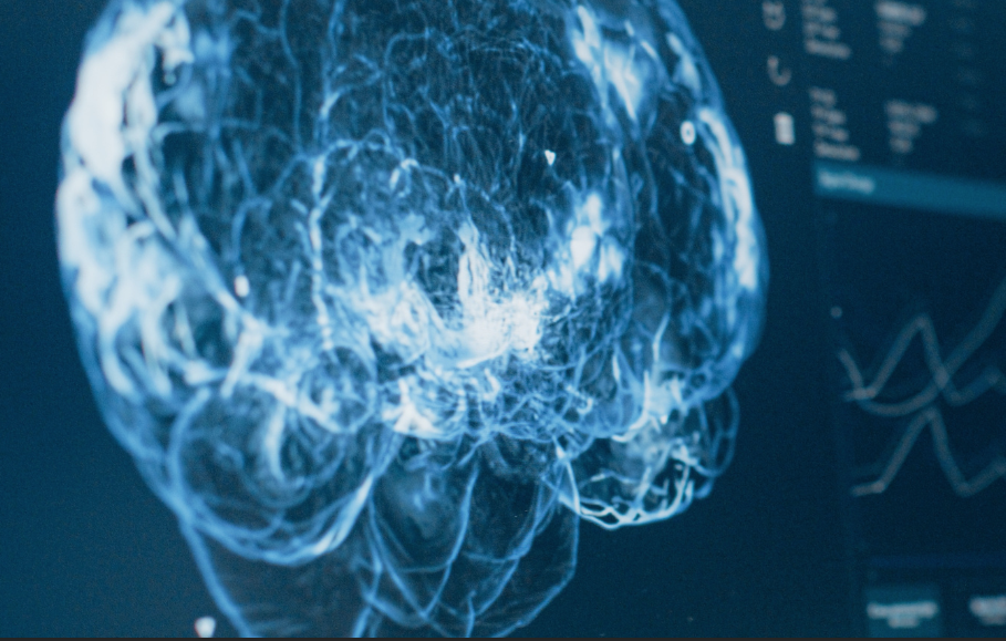 Nevron: Η νευροχειρουργική ομάδα που φέρνει την καινοτομία στο χειρουργείο