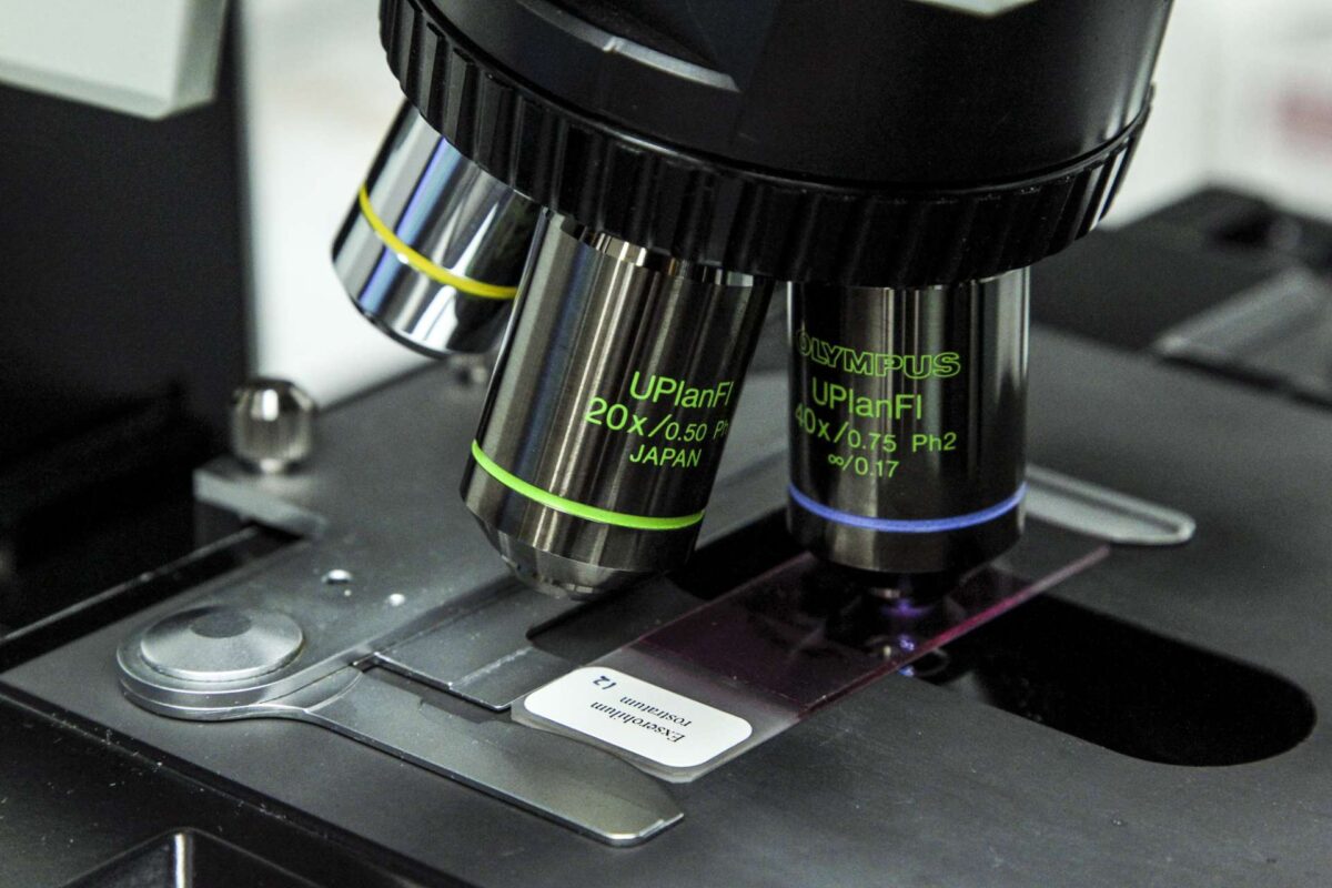 Βρετανία: Σε 27 ανέρχονται τα επιβεβαιωμένα και ύποπτα κρούσματα της επιδημίας μηνιγγίτιδας στην Αγγλία