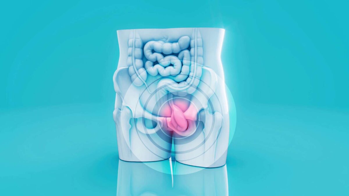 Ποιοι κινδυνεύουν από καρκίνο του παχέος εντέρου και πώς μπορούν να τον ελέγξουν