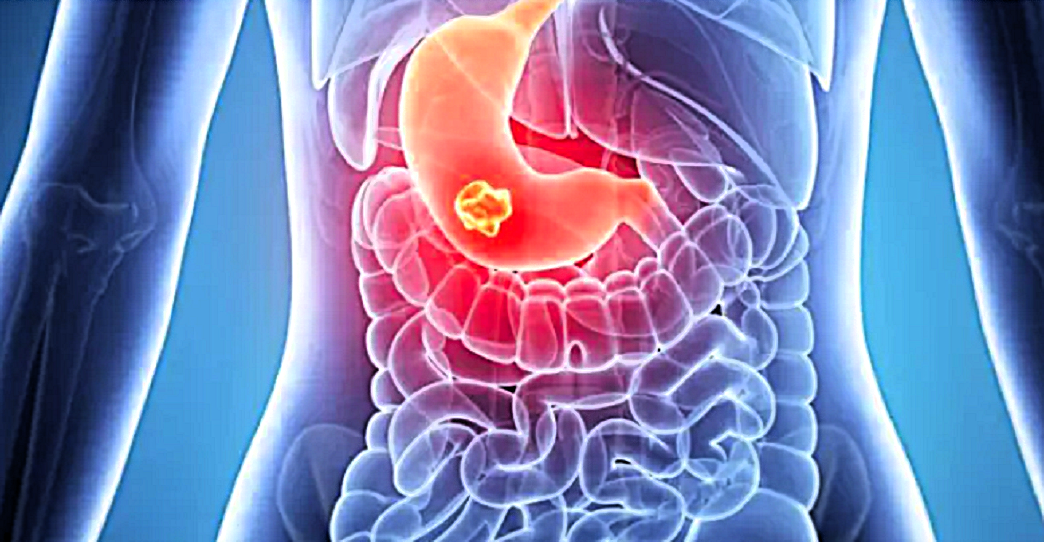 Με πεπτικά προβλήματα συνδέεται το άγχος κατά την πρώιμη παιδική ηλικία
