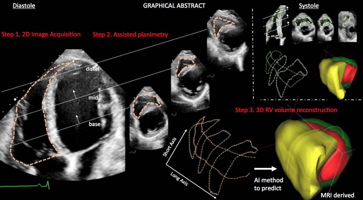 Πρωτοποριακή μέθοδος Ελλήνων επιστημόνων ανιχνεύει καρδιακά προβλήματα