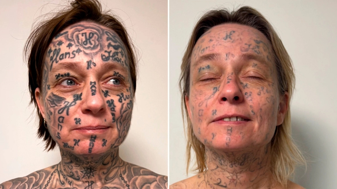 Απίστευτη κακοποίηση στην Ολλανδία: Έκανε τατουάζ 250 φορές το όνομά του στο κορμί της κοπέλας του!