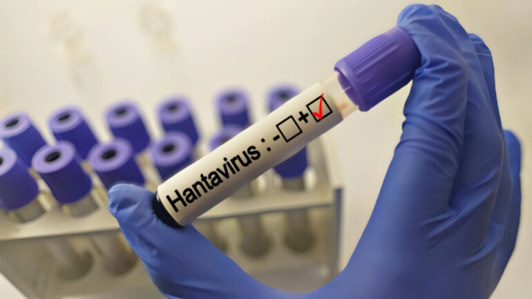Ισπανία: Νέο κρούσμα hantavirus.  Η επιδημία έφτασε τα 11 άτομα